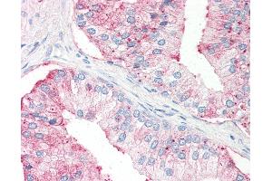 Anti-SLC39A14 antibody IHC of human prostate. (SLC39A14 anticorps  (Internal Region))