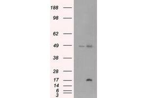 Image no. 1 for anti-Cancer/testis Antigen 1B (CTAG1B) antibody (ABIN1499904) (CTAG1B anticorps)