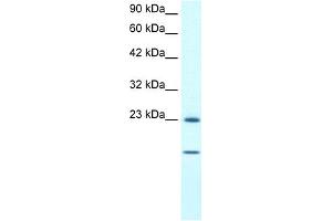 WB Suggested Anti-HSPB1 Antibody Titration:  1. (HSP27 anticorps  (C-Term))