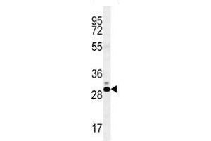 CT45A antibody western blot analysis in K562 lysate (CT45A1 anticorps  (AA 1-30))