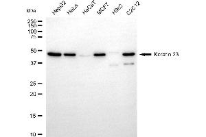 Western blotting analysis using keratin 23 antibody (ABIN7799177).