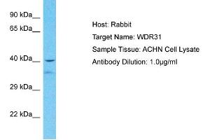Host: Rabbit Target Name: WDR31 Sample Tissue: Human ACHN Whole Cell  Antibody Dilution: 1ug/ml (WDR31 anticorps  (Middle Region))