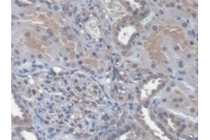 Detection of CXCL14 in Human Kidney Tissue using Polyclonal Antibody to Chemokine (C-X-C Motif) Ligand 14 (CXCL14)
