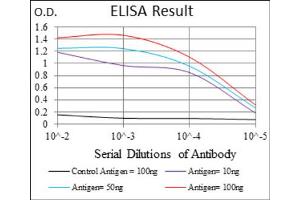 Red: Control Antigen (100ng) ; Purple: Antigen (10ng) ; Green: Antigen (50ng) ; Blue: Antigen (100ng). (FOXO1 anticorps)
