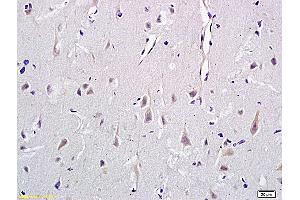 Formalin-fixed and paraffin embedded rat brain labeled with Anti-CD146/MCAM Polyclonal Antibody, Unconjugated (ABIN732143) at 1:400 followed by conjugation to the secondary antibody and DAB staining (MCAM anticorps  (AA 201-300))