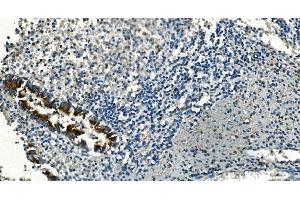 IHC analysis of IDH2 using anti-IDH2 antibody (ABIN7602786). (IDH2 anticorps  (C-Term))