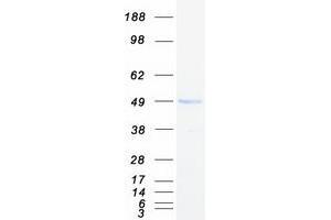 Validation with Western Blot