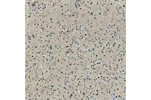 IHC analysis of SNRNP27 using anti-SNRNP27 antibody (ABIN7599614). (SNRNP27 anticorps  (AA 100-155))