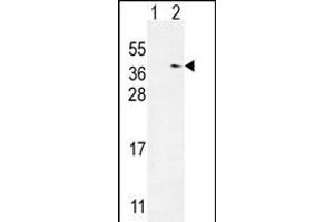 Western blot analysis of TXNDC6 (arrow) using rabbit polyclonal TXNDC6 Antibody (Center) (ABIN654968 and ABIN2844606).