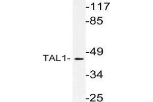Western blot analysis of TAL1 Antibody in extracts from Jurkat cells. (TAL1 anticorps)