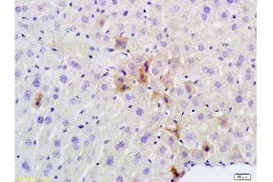 Formalin-fixed and paraffin embedded mouse liver labeled with Rabbit Anti phospho-GCN2 (Thr667) Polyclonal Antibody, Unconjugated  at 1:200 followed by conjugation to the secondary antibody and DAB staining (GCN2 anticorps  (pThr667))