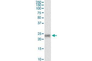 MYL5 monoclonal antibody (M03), clone 3D12.