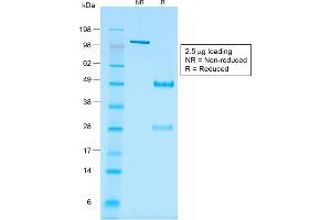 SDS-PAGE Analysis Purified Wilm's Tumor Mouse Recombinant Monoclonal Antibody (rWT1/857). (Recombinant WT1 anticorps)