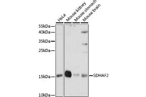 Western blot analysis of extracts of various cell lines, using SDH antibody (ABIN7270619) at 1:1000 dilution. (Sdhaf2 anticorps  (AA 1-166))