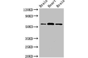 Western Blot Positive WB detected in: Rat brain tissue, Mouse heart tissue, Mouse brain tissue All lanes: ATG14 antibody at 2 μg/mL Secondary Goat polyclonal to rabbit IgG at 1/50000 dilution Predicted band size: 56, 43 kDa Observed band size: 56 kDa