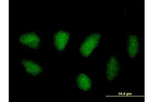 Immunofluorescence of purified MaxPab antibody to MAPK11 on HeLa cell. (MAPK11 anticorps  (AA 1-364))