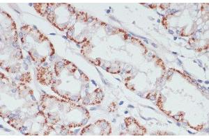Immunohistochemistry of paraffin-embedded Human stomach using ACSL3 Polyclonal Antibody at dilution of 1:100 (40x lens). (Acsl3 anticorps)