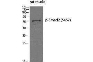 Western Blot (WB) analysis of specific cells using Phospho-Smad2 (S467) Polyclonal Antibody.