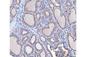 IHC analysis of KLHL12 using anti-KLHL12 antibody (ABIN7601008).