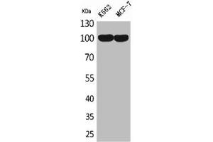 Western Blot analysis of K562 MCF7 cells using CD203c Polyclonal Antibody