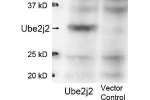 Image no. 1 for anti-Ubiquitin-Conjugating Enzyme E2, J2 (UBE2J2) (Internal Region) antibody (ABIN401475)