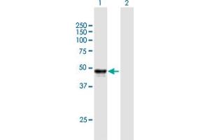 Western Blot analysis of SERPINH1 expression in transfected 293T cell line by SERPINH1 MaxPab polyclonal antibody. (SERPINH1 anticorps  (AA 1-418))