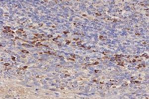 Immunohistochemistry analysis of paraffin-embedded human tonsil using,IL-3RB (ABIN7073557) at dilution of 1: 4000