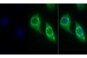 Detection of CK19 in Human Hela cell using Monoclonal Antibody to Cytokeratin 19 (CK19) (Cytokeratin 19 anticorps  (AA 245-391))