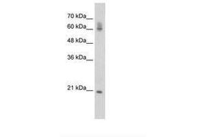Image no. 1 for anti-FIP1 Like 1 (FIP1L1) (AA 509-558) antibody (ABIN6736286) (FIP1L1 anticorps  (AA 509-558))