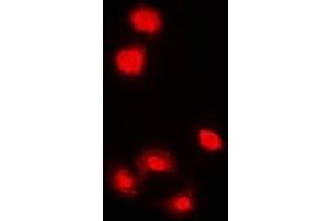 Immunofluorescent analysis of AMPK alpha 1 staining in HeLa cells.