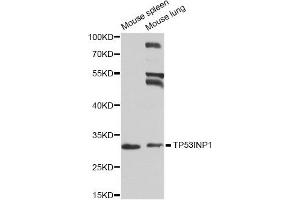 Western blot analysis of extracts of mouse spleen and mouse lung cell lines, using TP53INP1 antibody. (TP53INP1 anticorps)