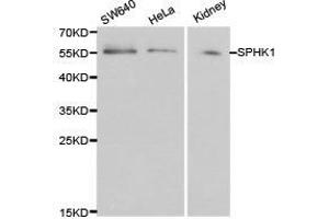 Western Blotting (WB) image for anti-Sphingosine Kinase 1 (SPHK1) antibody (ABIN1874920) (SPHK1 anticorps)