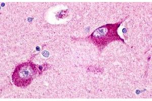 anti-Histamine Receptor H3 (HRH3) (Cytoplasmic Domain) antibody