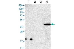 Western Blot analysis of Lane 1: RT-4 cell, Lane 2: U-251 MG sp cell, Lane 3: human plasma tissue (IgG/HSA depleted) and Lane 4: human liver tissue lysates with CNTLN polyclonal antibody . (CNTLN anticorps)