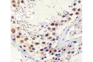 Immunohistochemical analysis of paraffin-embedded human testis using TBP antibody at 1:25 dilution. (TBP anticorps)