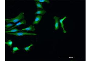 Immunofluorescence of purified MaxPab antibody to PTPN2 on HeLa cell.