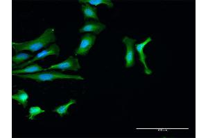 Immunofluorescence of purified MaxPab antibody to PTPN2 on HeLa cell. (PTPN2 anticorps  (AA 1-387))