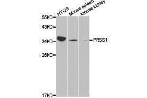 Western Blotting (WB) image for anti-Protease, serine, 1 (Trypsin 1) (PRSS1) antibody (ABIN1874350) (PRSS1 anticorps)