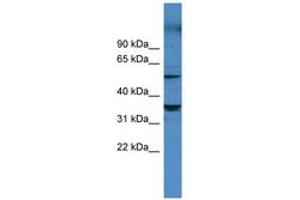 Image no. 1 for anti-Cytochrome P450, Family 11, Subfamily B, Polypeptide 1 (CYP11B1) (AA 202-251) antibody (ABIN6746766) (CYP11B1 anticorps  (AA 202-251))