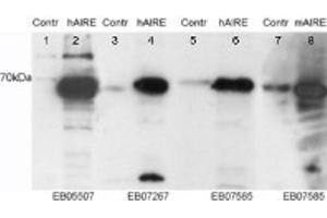 Western Blotting (WB) image for anti-Autoimmune Regulator (AIRE) (Internal Region) antibody (ABIN2465376) (AIRE anticorps  (Internal Region))
