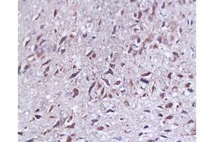 Formalin-fixed and paraffin embedded rat brain tissue labeled with Anti-SYP p38/Synaptophysin/SAP-1 Polyclonal Antibody, Unconjugated  at 1:200, followed by conjugation to the secondary antibody and DAB staining (SYAP1 anticorps  (AA 151-230))