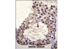 anti-Otoancorin (OTOA) (AA 92-120), (N-Term) antibody