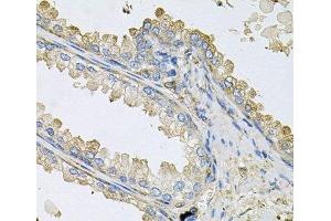 Immunohistochemistry of paraffin-embedded Human prostate using PPIC Polyclonal Antibody at dilution of 1:100 (40x lens).