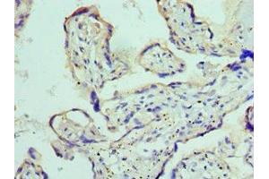 Immunohistochemistry of paraffin-embedded human placenta tissue using ABIN7150066 at dilution of 1:100 (ADAM9 anticorps  (AA 475-685))