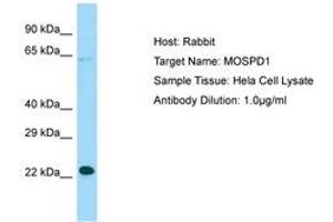 Image no. 1 for anti-Motile Sperm Domain Containing 1 (MOSPD1) (N-Term) antibody (ABIN6750115)