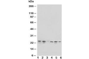Western blot testing of HSPB1 antibody and Lane 1:  rat liver;  and human samples 2: HeLa;  3: MCF-7;  4: HT1080;  5: COLO320 cell lysate.