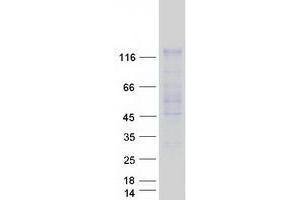 Validation with Western Blot