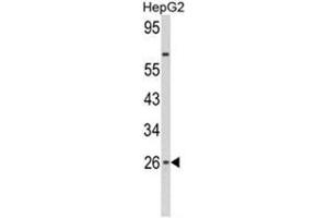 Western blot analysis of IFNB1 Antibody (N-term) in HepG2 cell line lysates (35ug/lane). (IFNB1 anticorps  (N-Term))