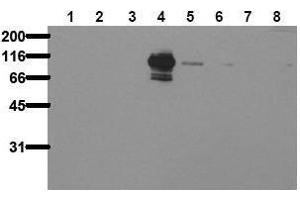 Western Blotting (WB) image for anti-PTK2B Protein tyrosine Kinase 2 beta (PTK2B) (pTyr402) antibody (ABIN126880) (PTK2B anticorps  (pTyr402))