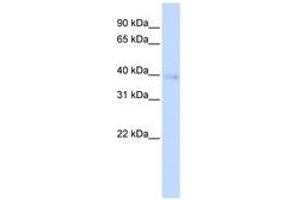 Image no. 1 for anti-Homeobox A11 (HOXA11) (AA 144-193) antibody (ABIN6741430) (Homeobox A11 anticorps  (AA 144-193))